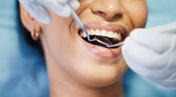 Best Emergency Cosmetic Dentistry (e.g., broken veneers) in Wilsonville, OR