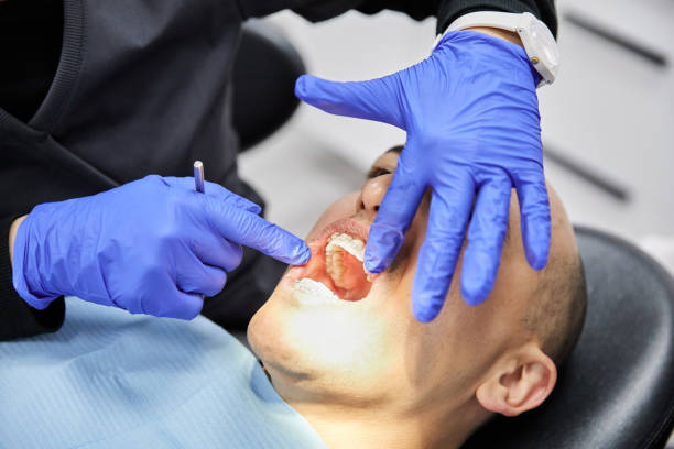 Best Emergency Denture Repair in Wilsonville, OR