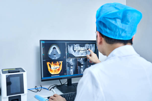 Best Dental Abscess Treatment in Wilsonville, OR